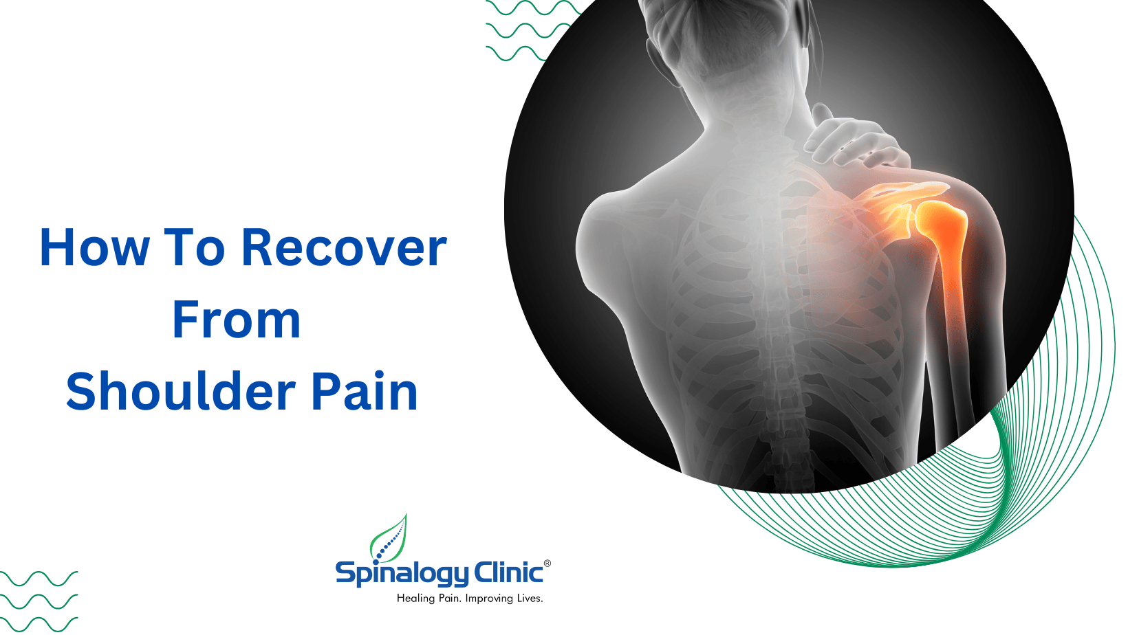 How To Recover From Shoulder Pain